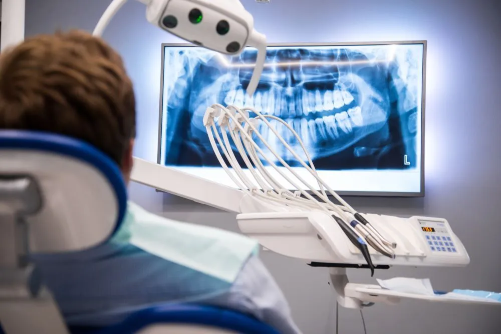 Radiografie dentara: ce este si cand se recomanda
