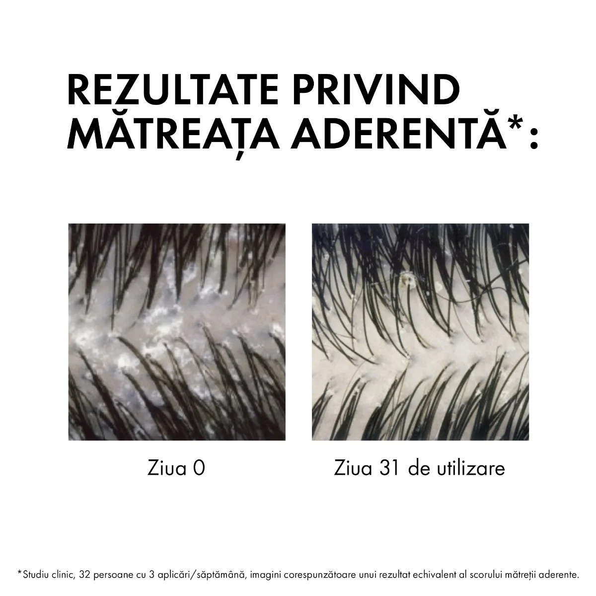 Rezerva Eco Sampon anti-matreata pentru par normal si gras Dercos, 390ml, Vichy