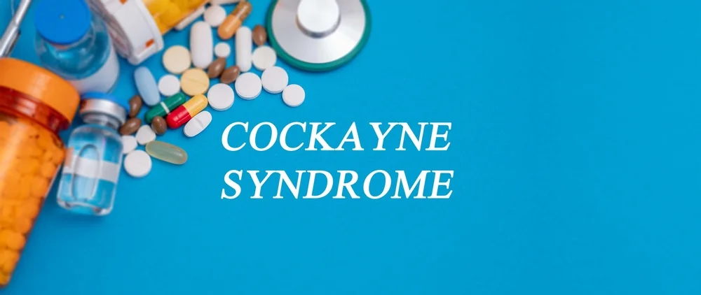 Sindrom Cockayne: cauze, simptome, tratament