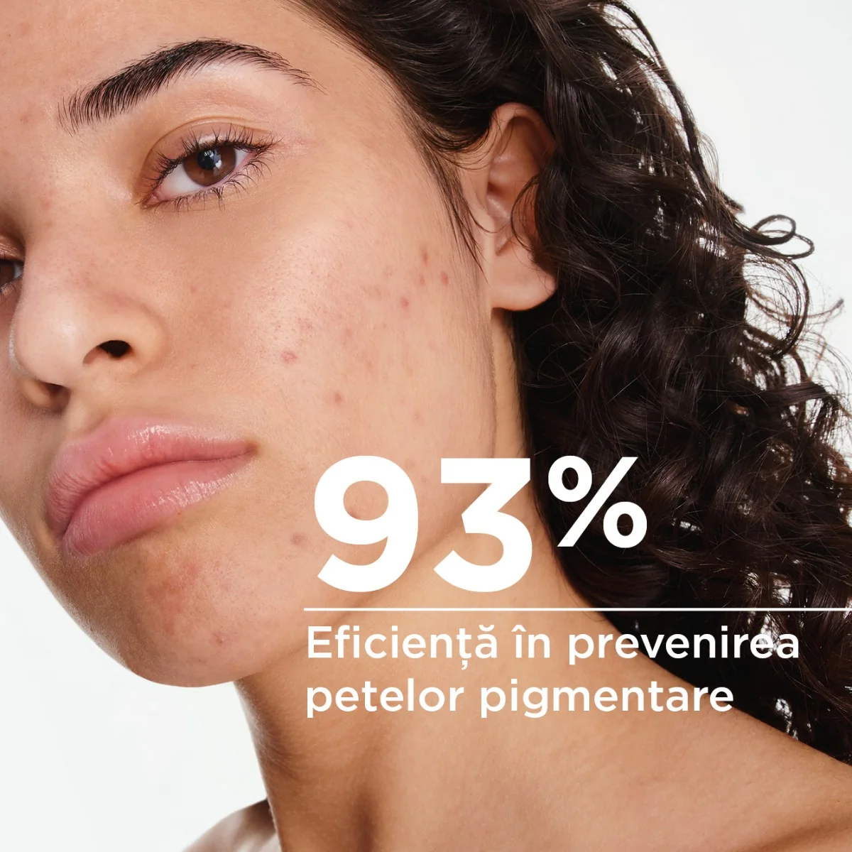 Gel-crema anti-imperfectiuni cu actiune keratolitica si protectie solara pentru ten predispus la acnee Sebium Kerato+ SPF 30, 30ml, Bioderma