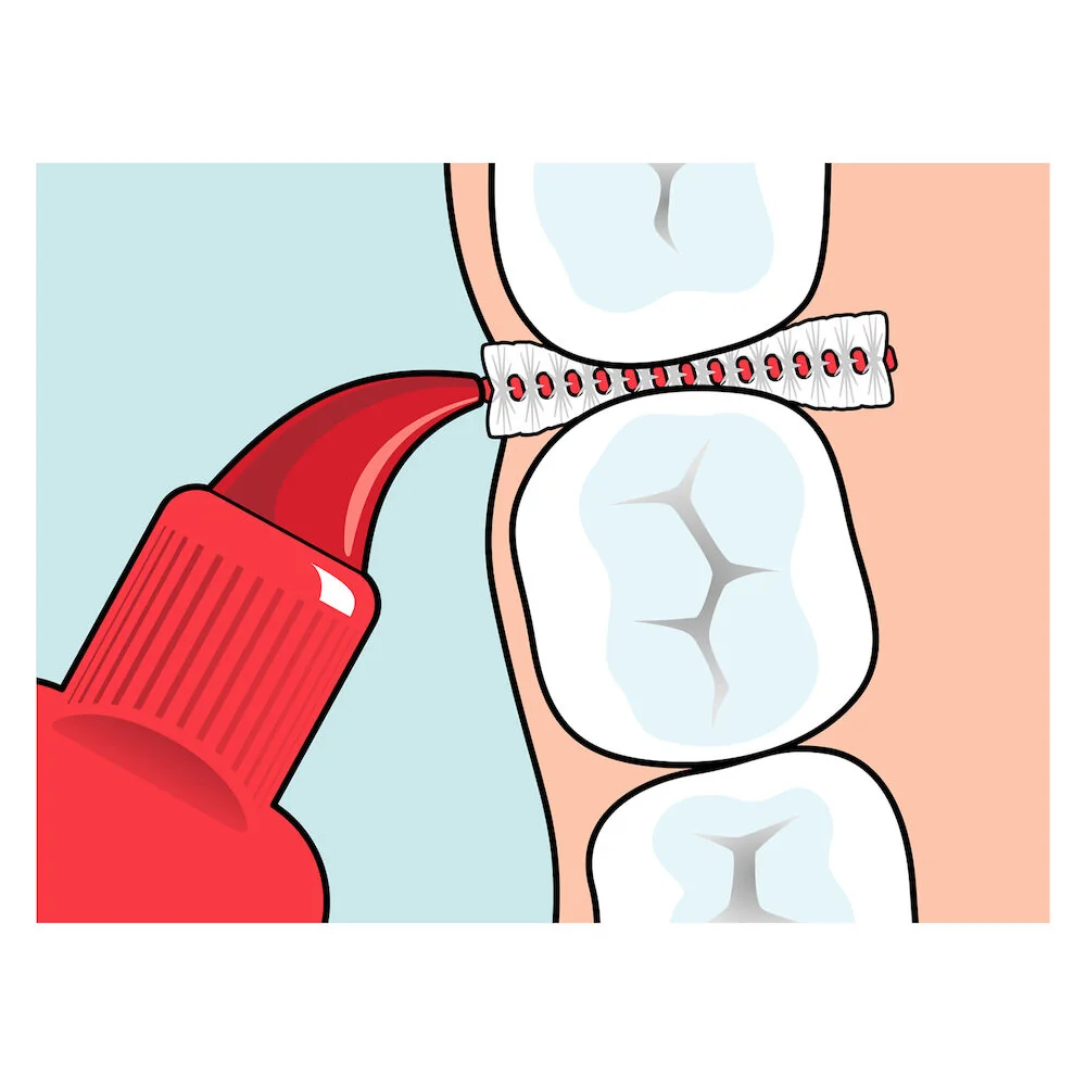 Set periute interdentare Original rosu, 8 bucati, TePe