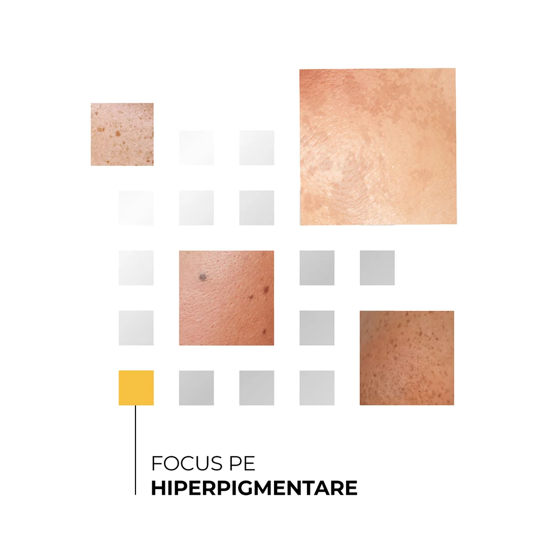 Skinexpert by Dr. Max® Crema de fata pentru luminozitate Spotlight, 50ml