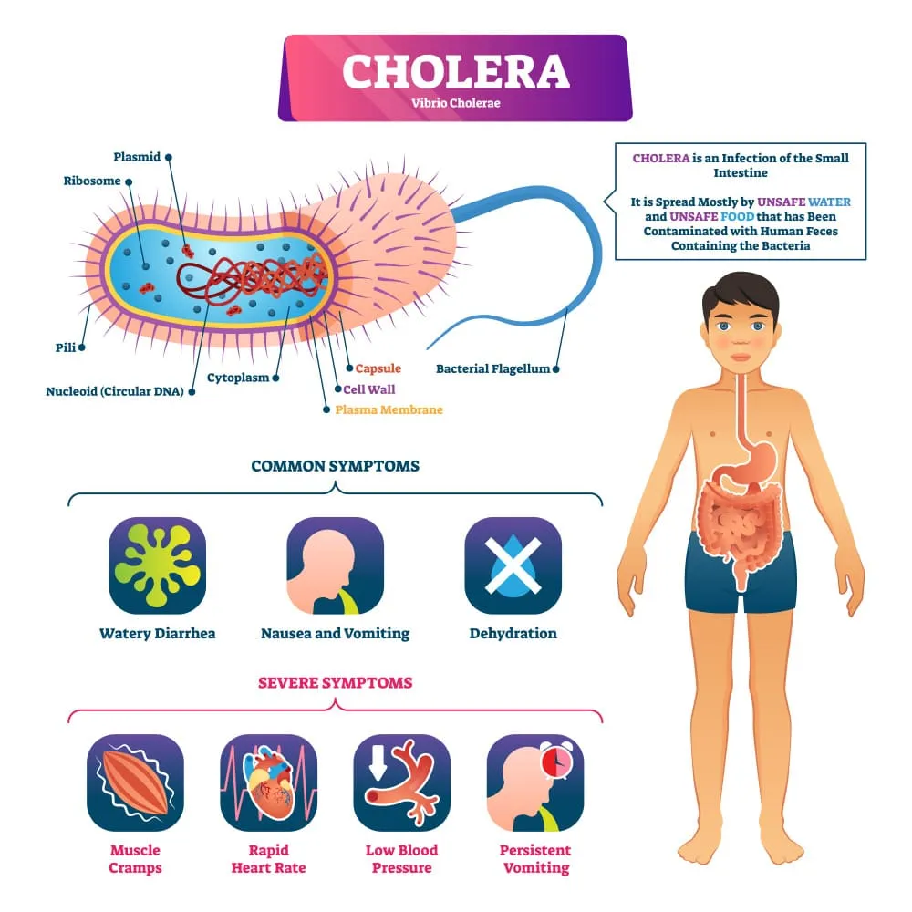Simptome in holera