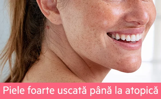 Piele uscata pana la atopica Piele uscata pana la atopica