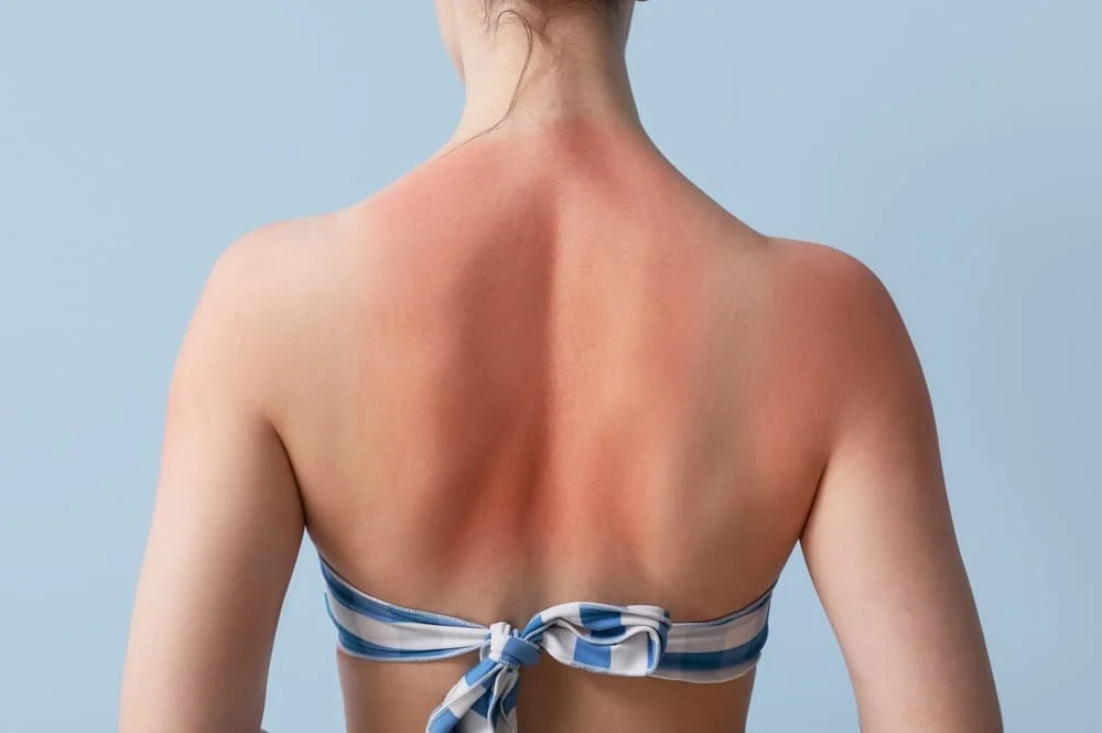 After sun vs crema hidratanta obisnuita: ce alegi dupa o zi la soare?