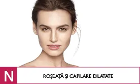 Gama N - Vase capilare dilatate