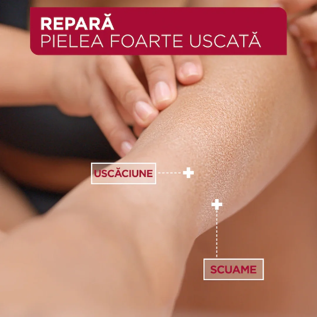 Lapte de corp reparator pentru pielea uscata si fragilizata Urea Cica Repair, 400ml, Mixa