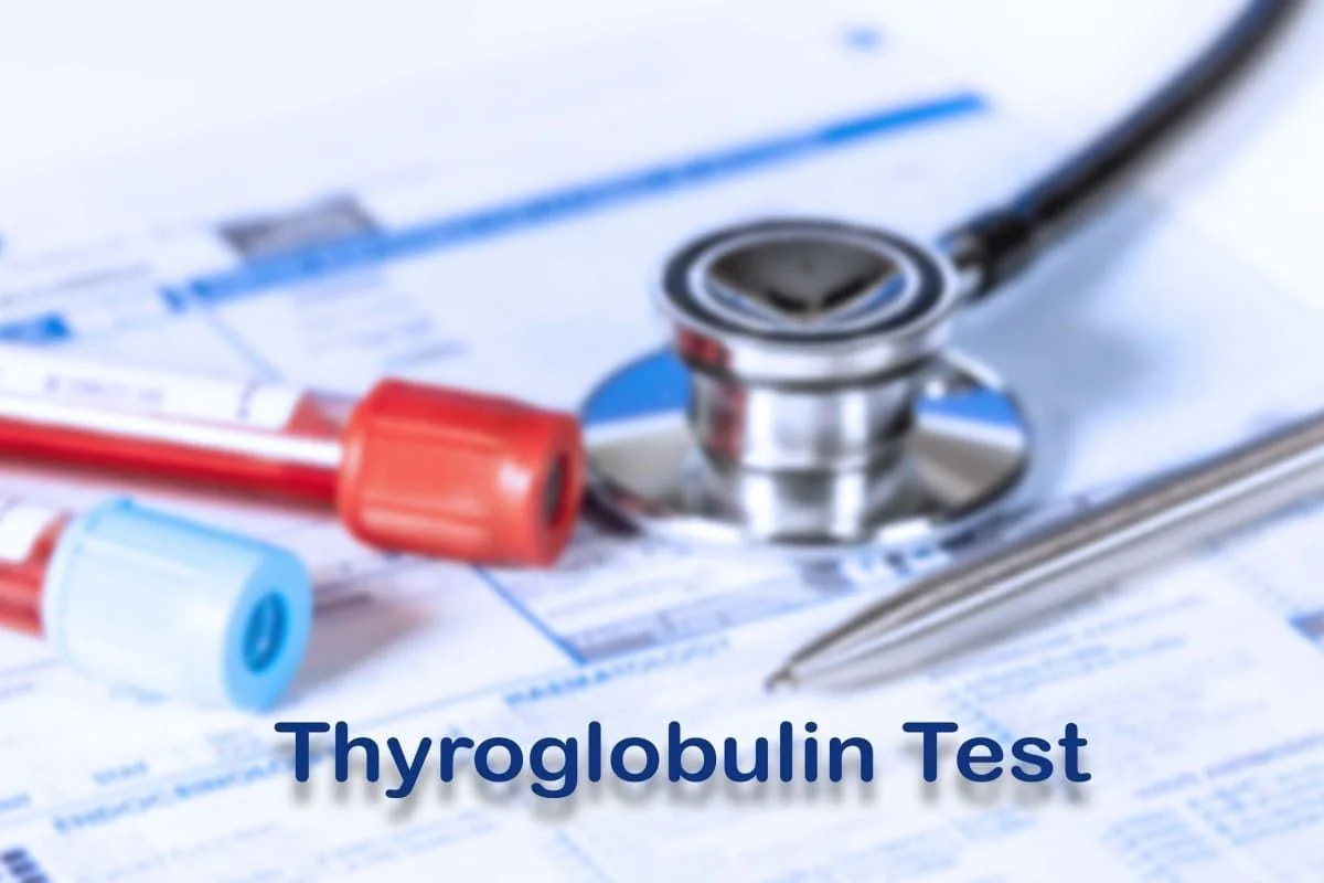 Tiroglobulina: ce este, importanta, recomandari, valori