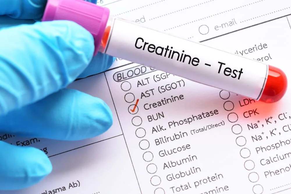Alimente interzise in creatinina marita: ce trebuie sa stii