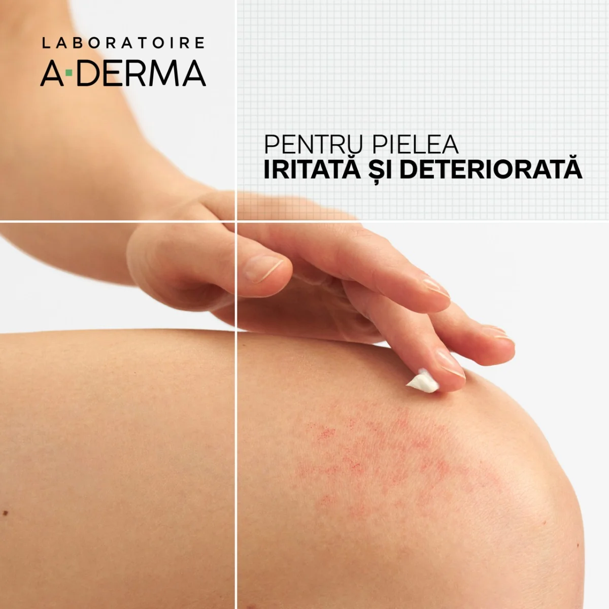 Crema anti-iritatii Dermalibour+Cica, 100 ml, A-Derma