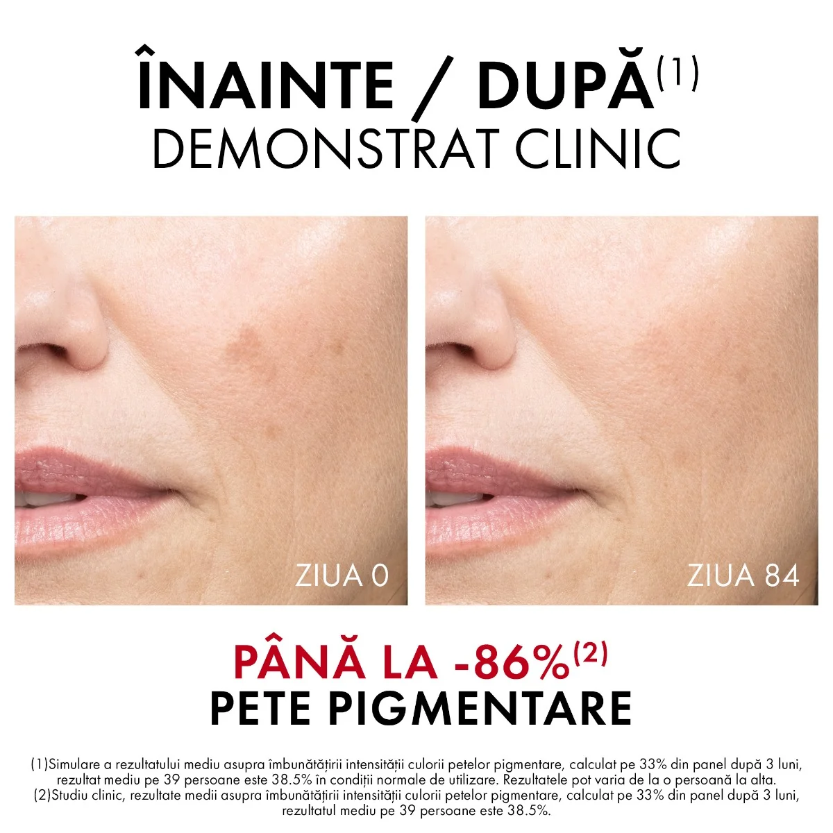 Ser B3 impotriva petelor pigmentare brune Liftactiv Specialist, 30ml, Vichy