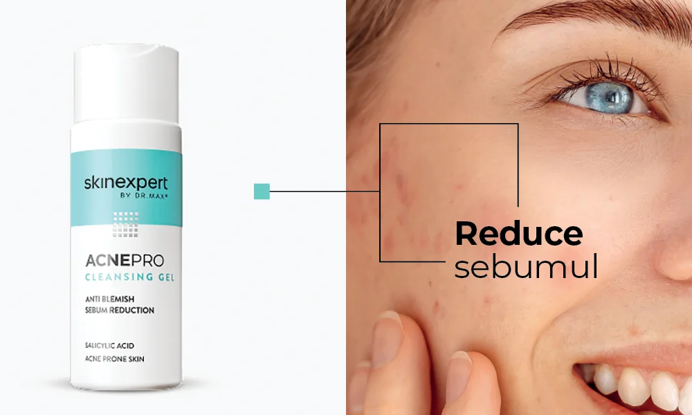 Skinexpert by Dr. MaxÂ® Gel de curatare anti-imperfectiuni AcnePro ...