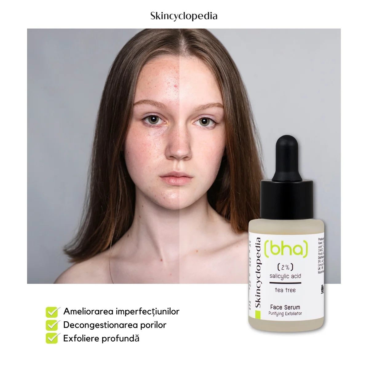 Ser facial cu 2% acid salicilic + ulei arbore de ceai, 30ml, Skincyclopedia