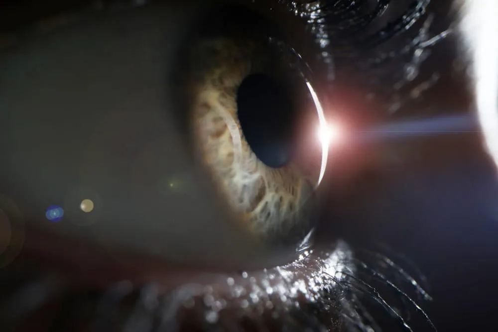 Dezlipirea de retina: cauze, manifestari si optiuni de tratament