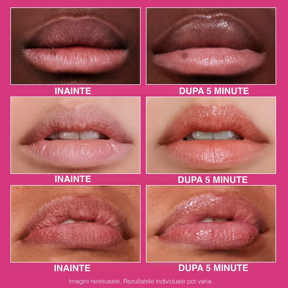 Tratament pentru buze FirmX Lip Filler, 10ml, Peter Thomas Roth