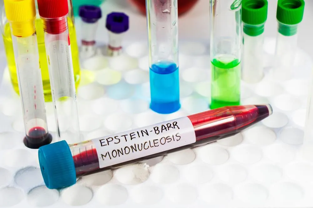 Infectia cu Virusul Epstein-Barr: Transmitere, manifestari si optiuni de tratament