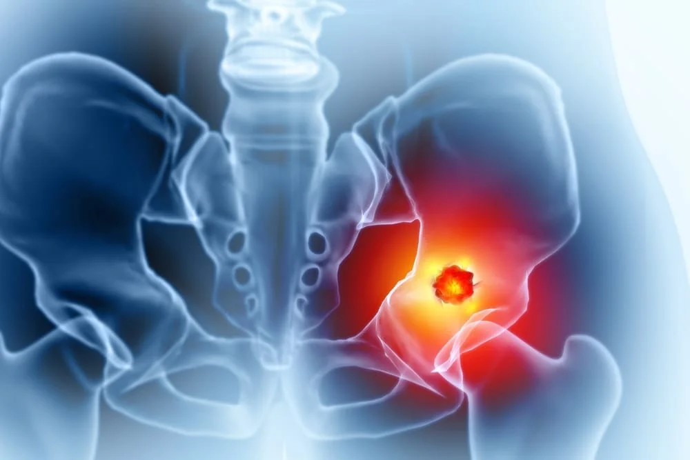 Osteita: cauze, simptome, tratament