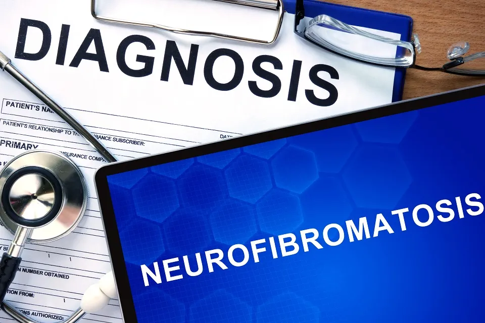 Diagnosticarea Neurofibromatozei