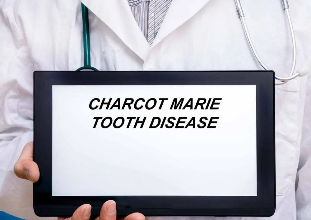 Boala Charcot-Marie-Tooth: cauze, simptome, tratament