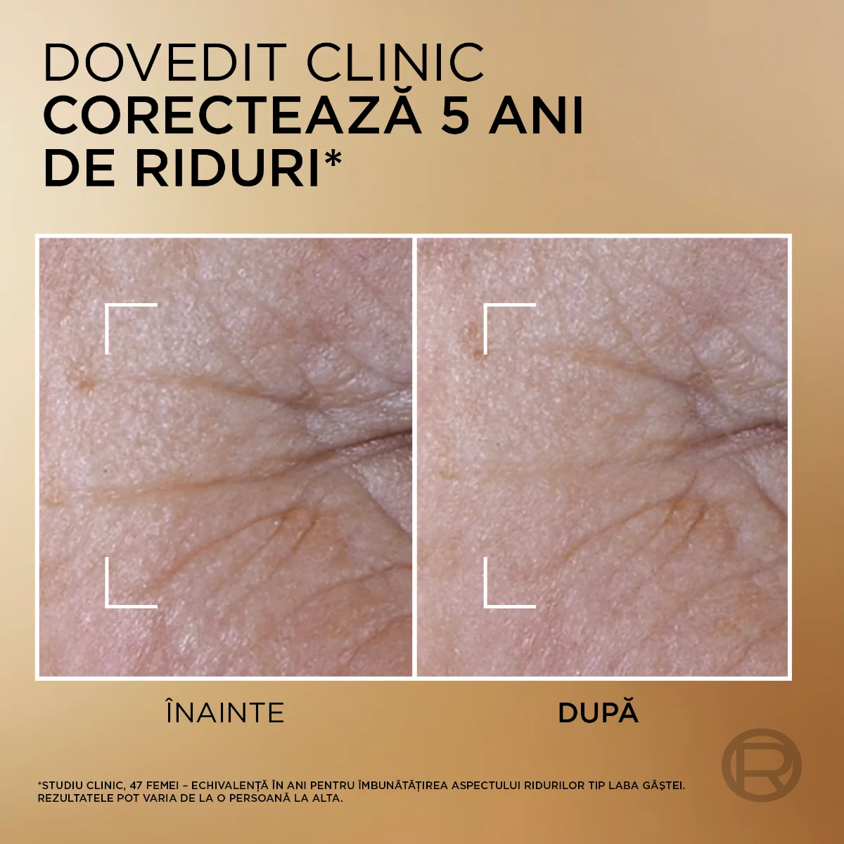 Serum 2 in 1 pentru fermitate Le Duo Age Perfect, 15ml, L'Oreal Paris
