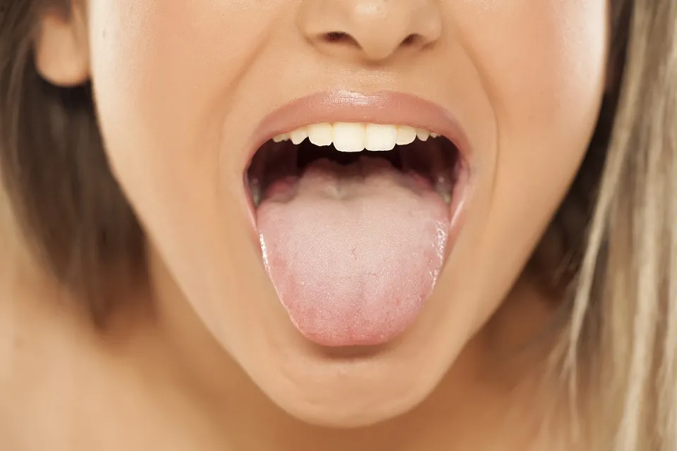 Durerea de limba