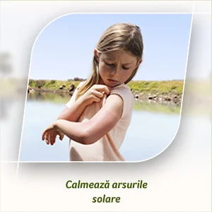 Calmeaza arsurile solare. Calmeaza arsurile solare.