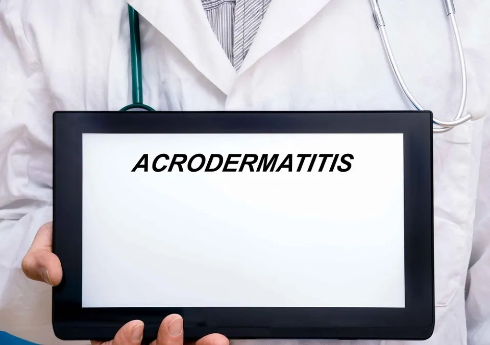 Acrodermatitis