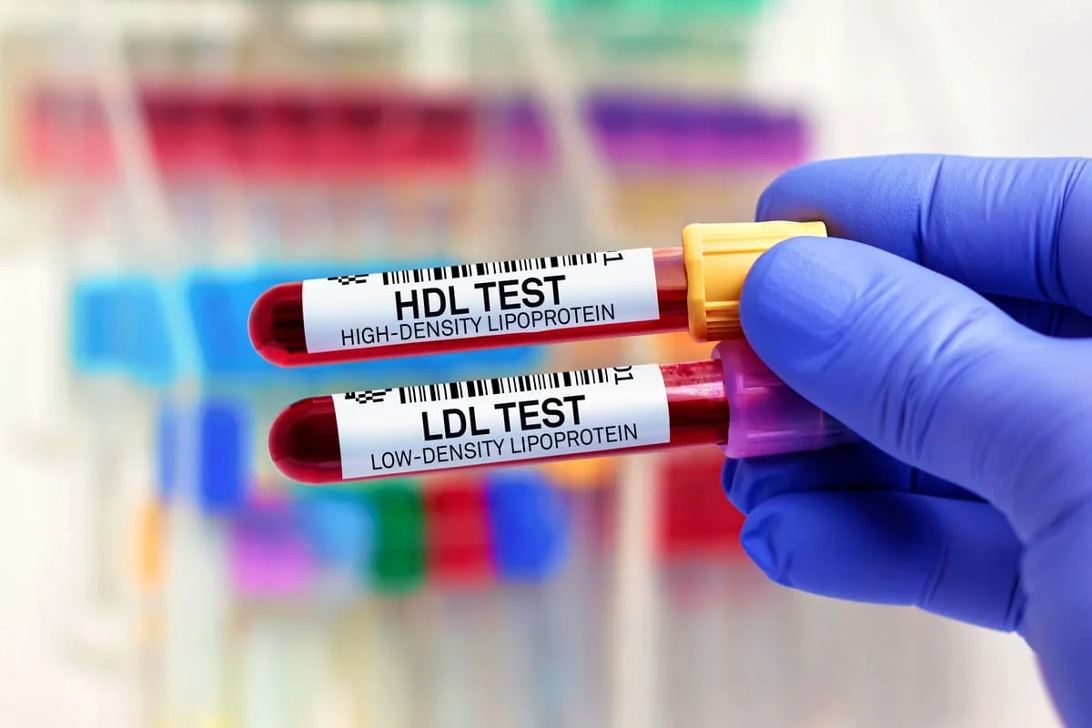 Hipobetalipoproteinemia: cauze, simptome, tratament