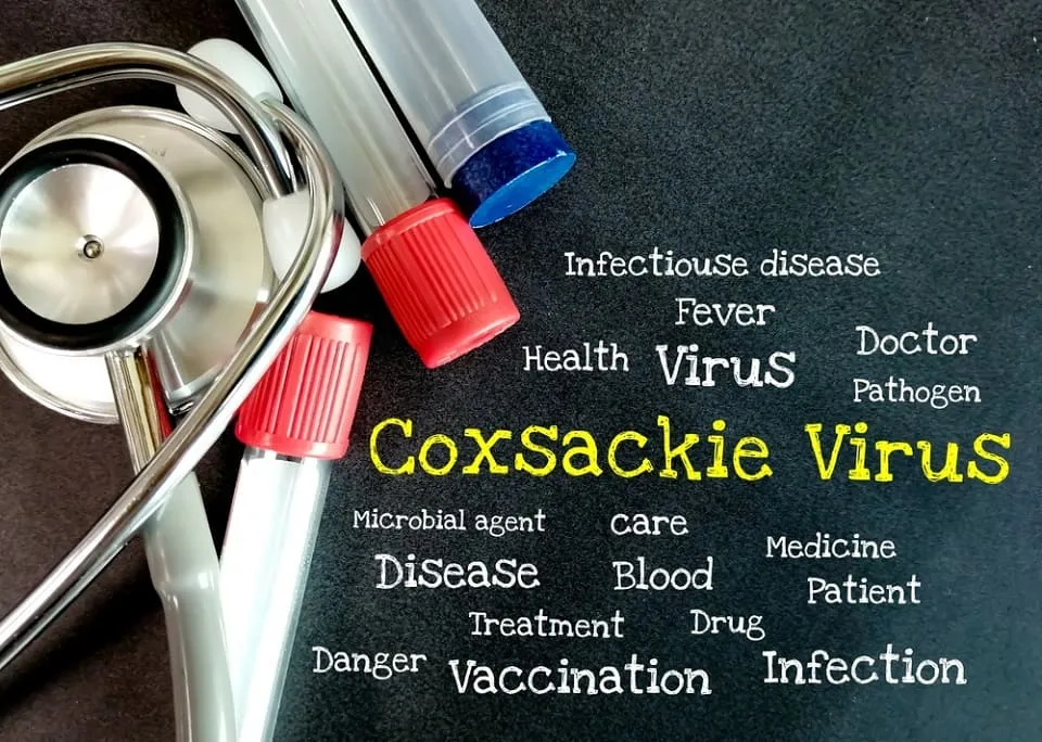 Virusul Coxsackie