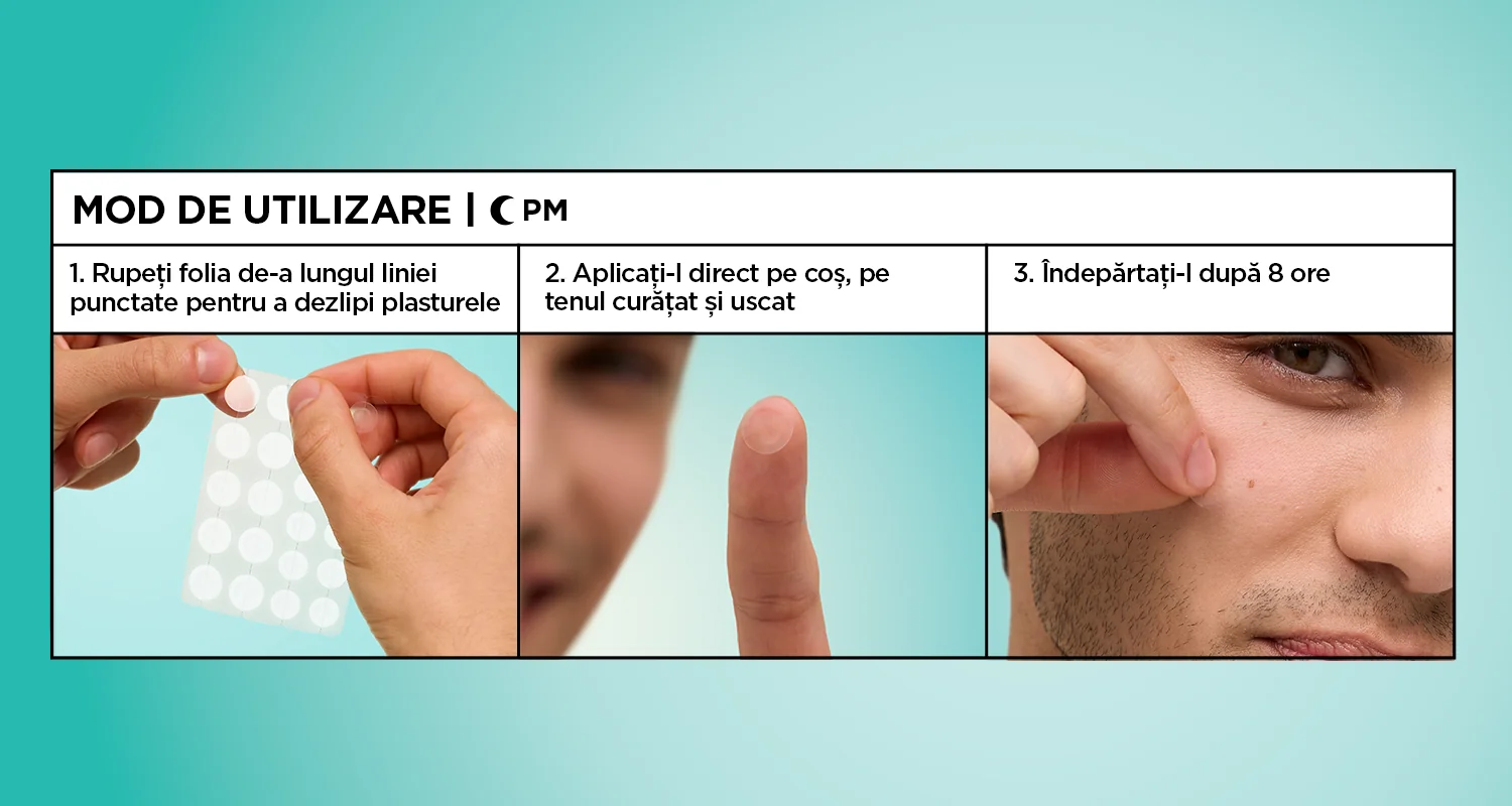 Mod de utilizare plasturi pentru cosuri: aplicare pe ten curat si indepartare dupa 8 ore. Mod de utilizare plasturi pentru cosuri: aplicare pe ten curat si indepartare dupa 8 ore.