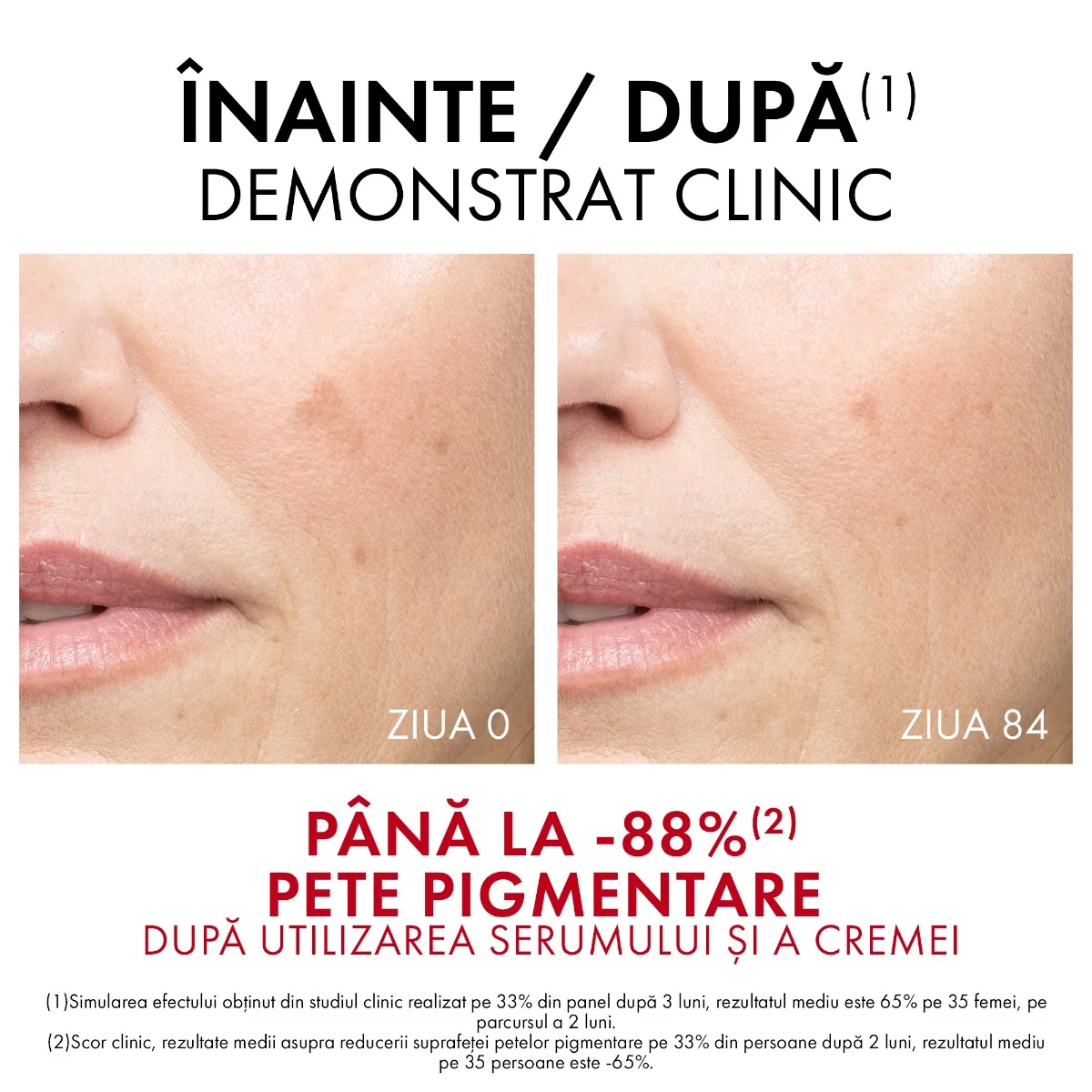 Crema de zi pentru corectarea tenului cu pete pigmentare B3 Liftactiv Specialist SPF50, 50ml, Vichy
