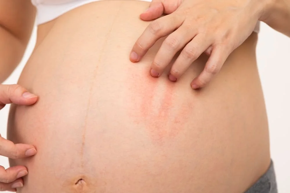 Mancarimi in sarcina: cand sunt normale si cand necesita consult medical?