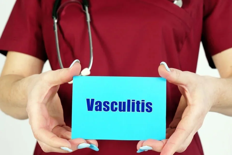 Vasculita: cauze, manifestari si optiuni de tratament