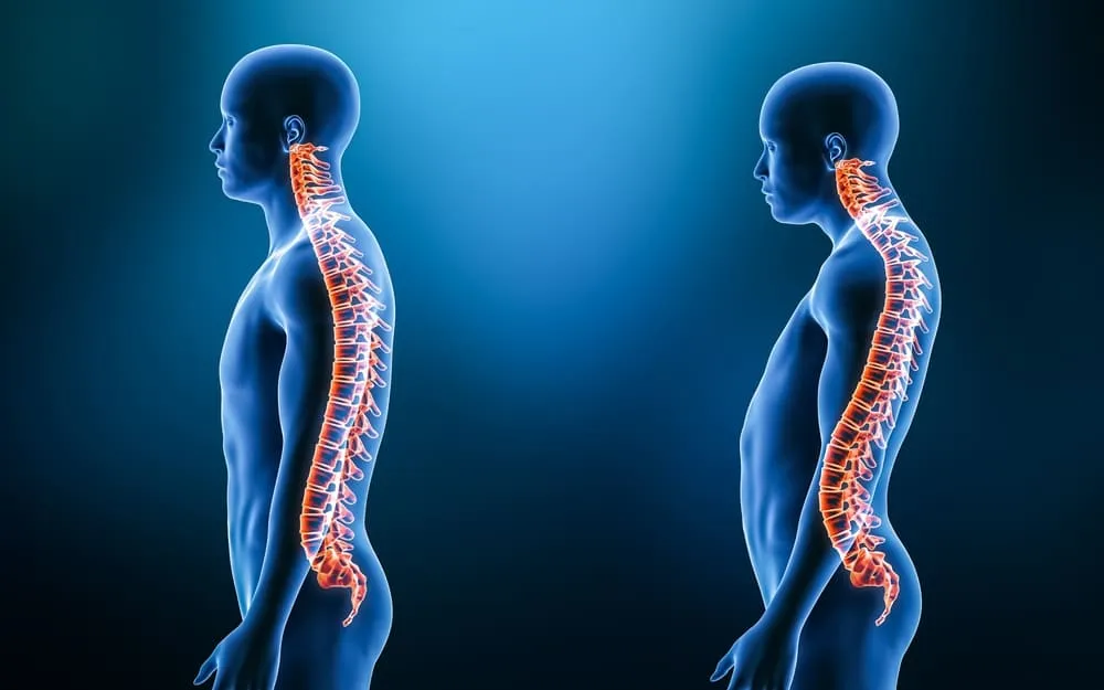 prevenirea și tratamentul bolilor coloanei vertebrale