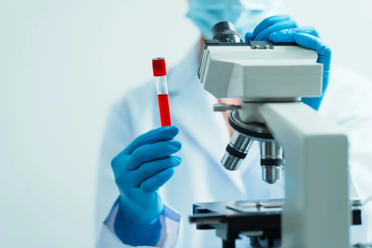 Diagnostic pentru plachetocritul crescut Diagnostic pentru plachetocritul crescut