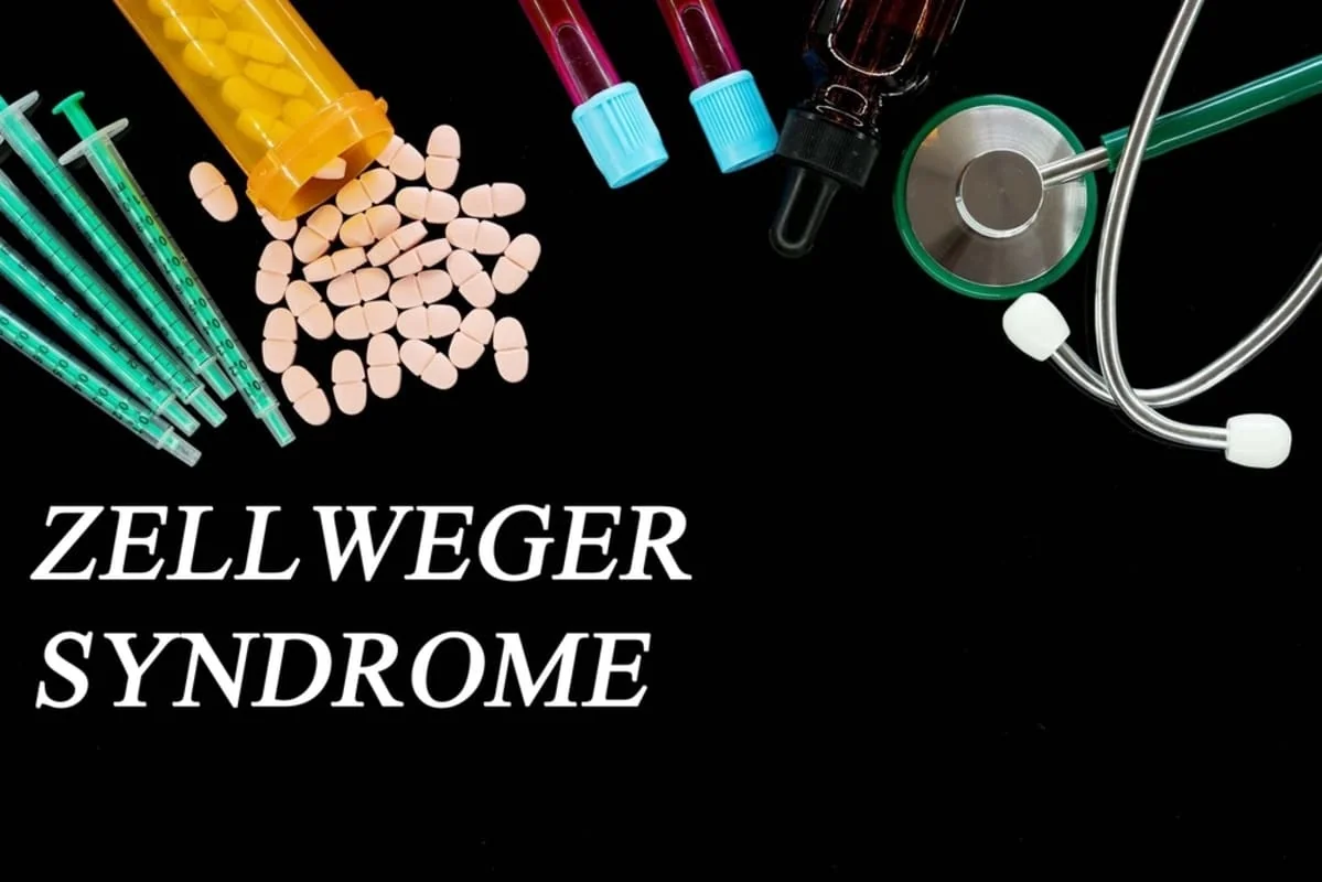 Sindromul Zellweger: cauze, simptome, tratament