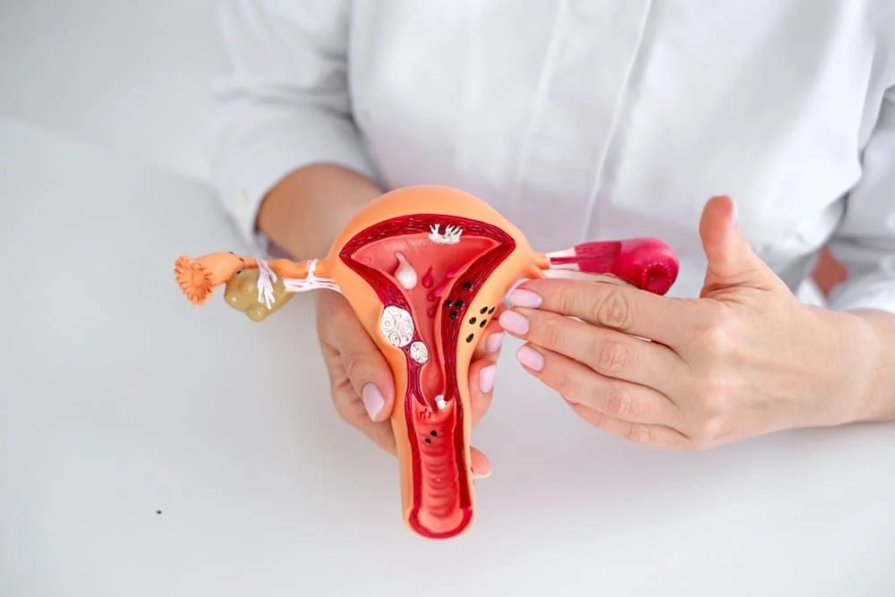 Fibrom uterin: simptome, cauze si tratament