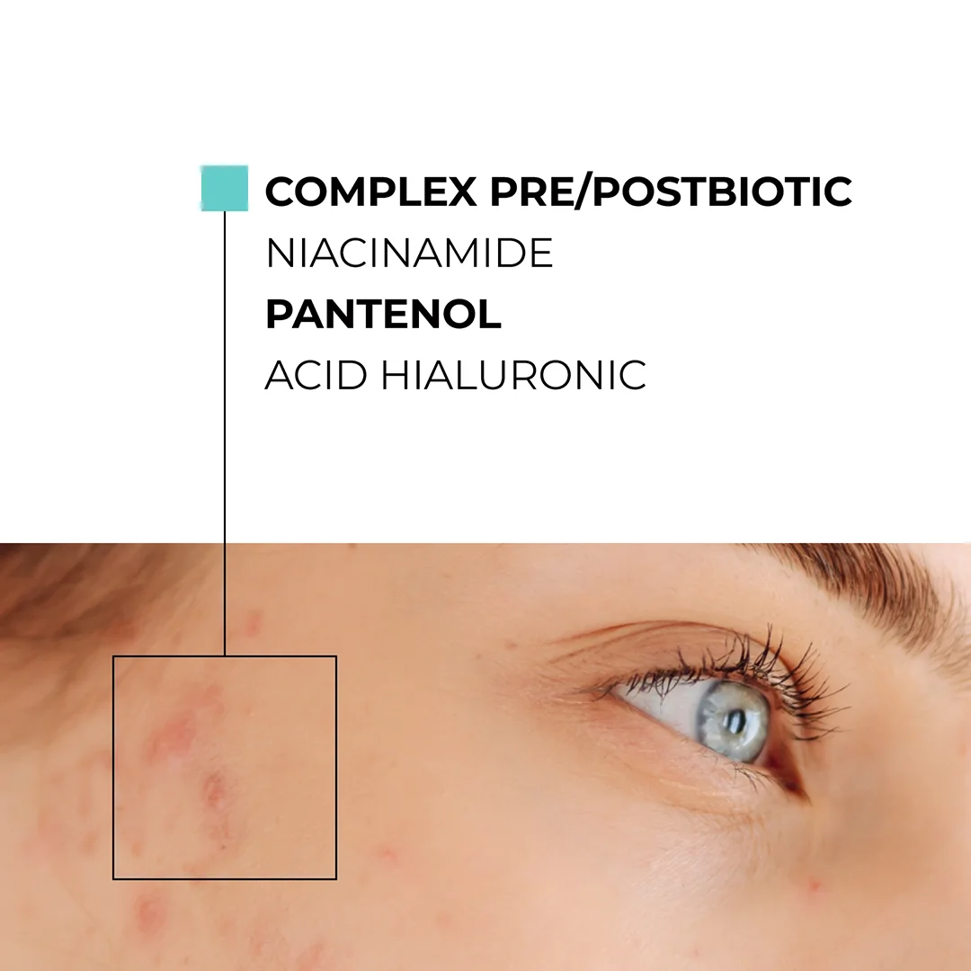 Skinexpert by Dr. Max® Crema de fata anti-imperfectiuni AcnePro, 50ml