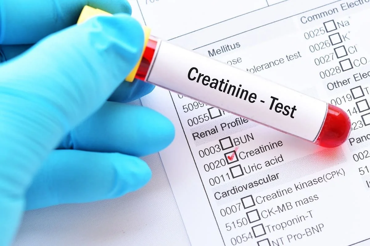Creatinina serica: valori, semnificatie, recomandari