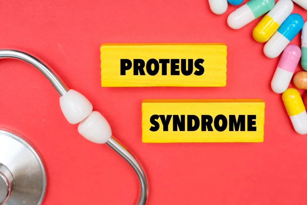 Sindromul Proteus: cauze, simptome, tratament