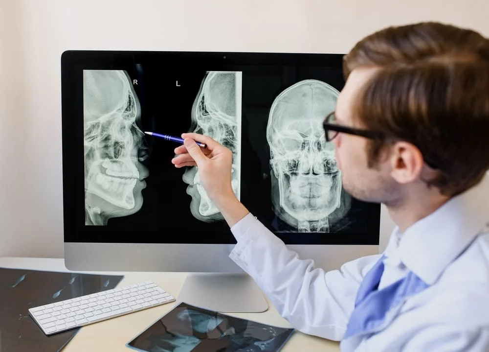 Osul zigomatic: ce este, anatomie, functii, rol