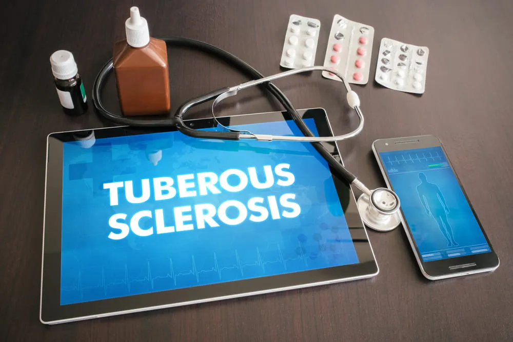 Scleroza tuberoasa