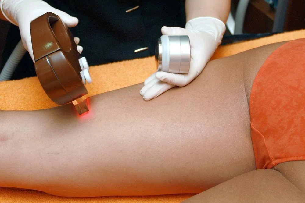 Hipertricoza: cauze, simptome, tratament