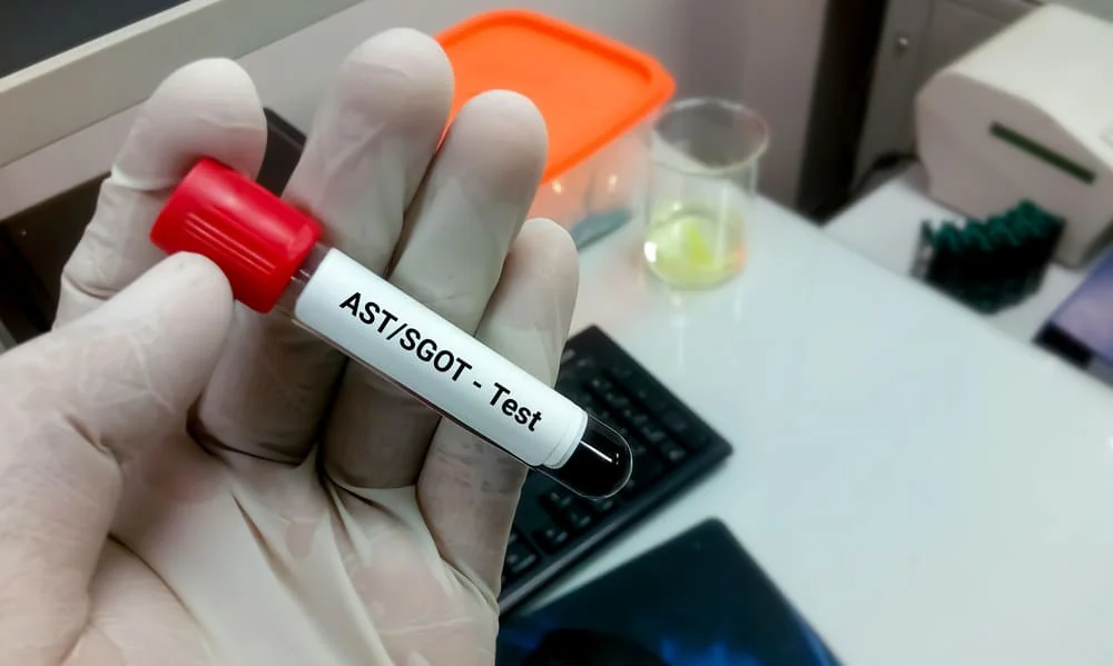 ASTS - SGT - test ASTS - SGT - test