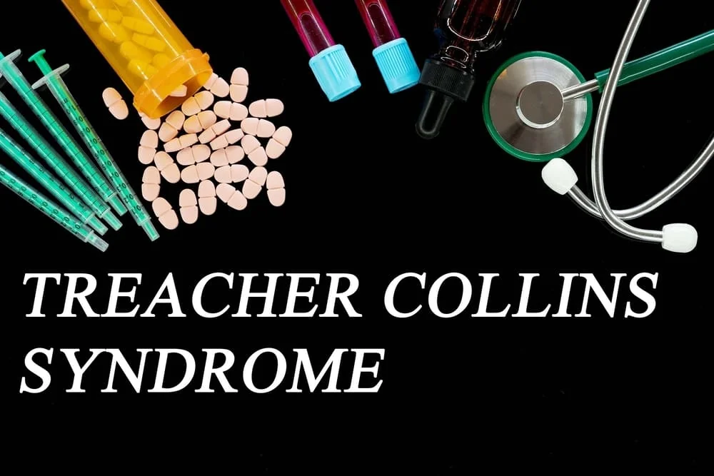 Sindrom Treacher Collins: cauze, simptome, tratament