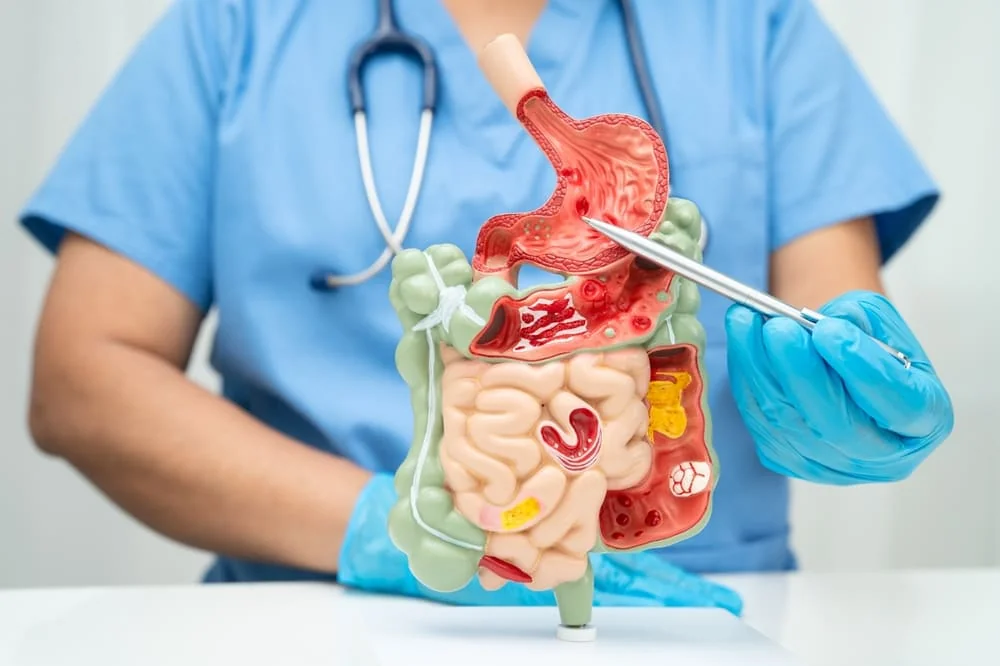 Tranzit intestinal accelerat: cauze metabolice, infectioase si emotionale