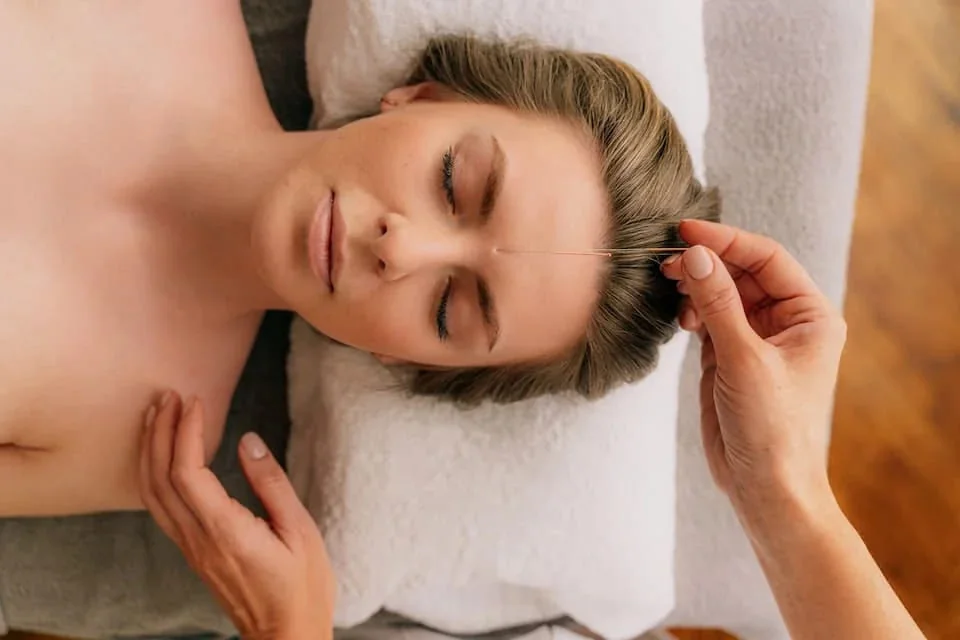 acupunctura acupunctura