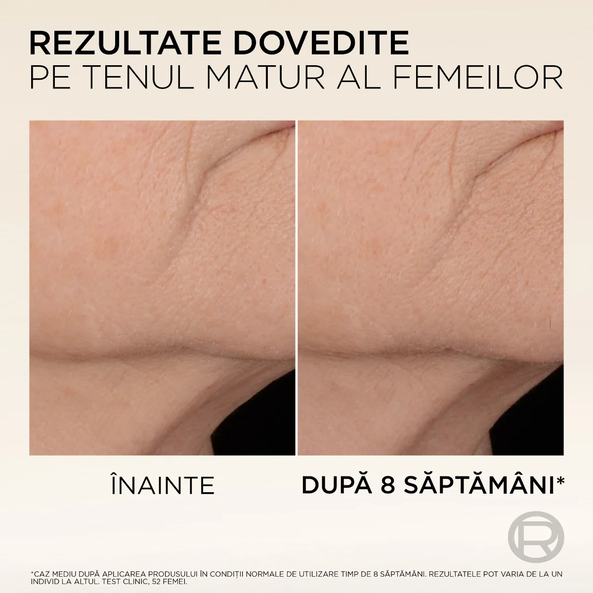 Serum pentru fermitate cu micro-peptide de colagen Age Perfect Collagen Expert, 30ml, L'Oreal Paris