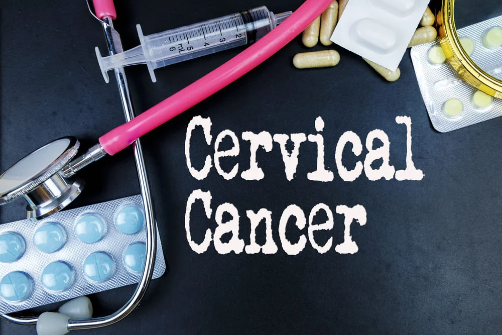 Cervical cancer Cervical cancer