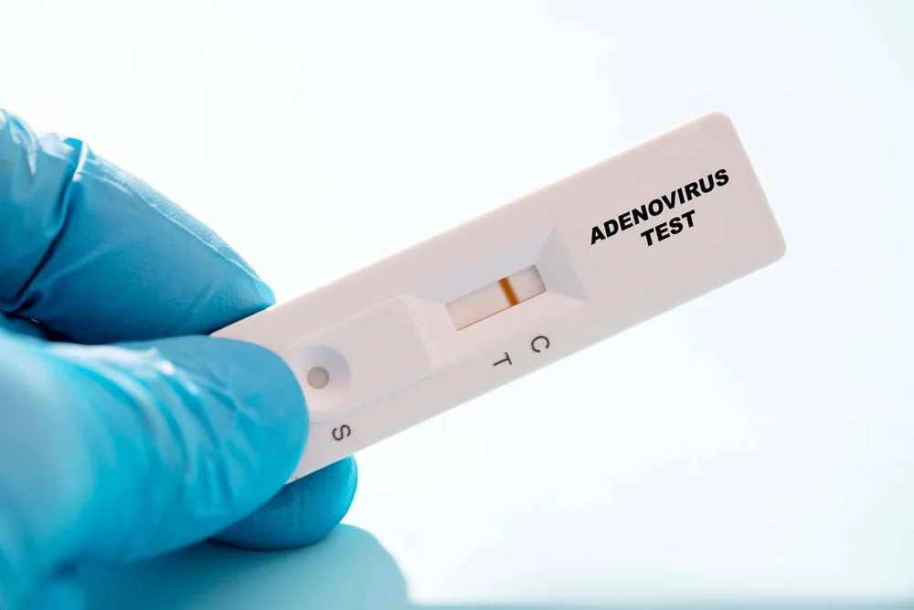 Adenovirus: ce trebuie sa stii despre el?